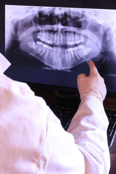 Best Emergency Denture Repair in Sacred Heart University, CT