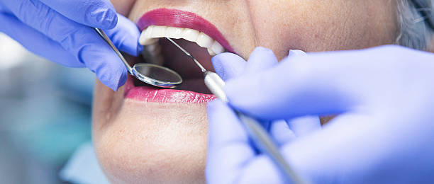 Best Urgent Care for Lost Fillings or Crowns in Sacred Heart University, CT